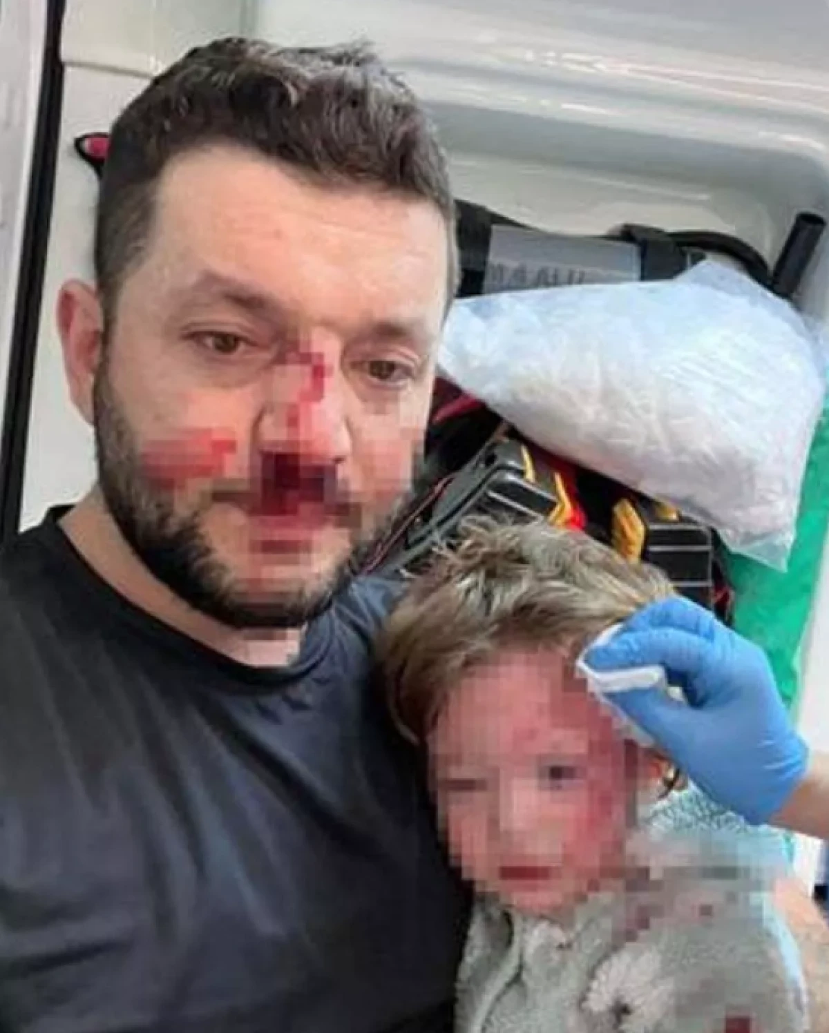 14 aylık bebeğin kafatası &ccedil;atlamıştı           