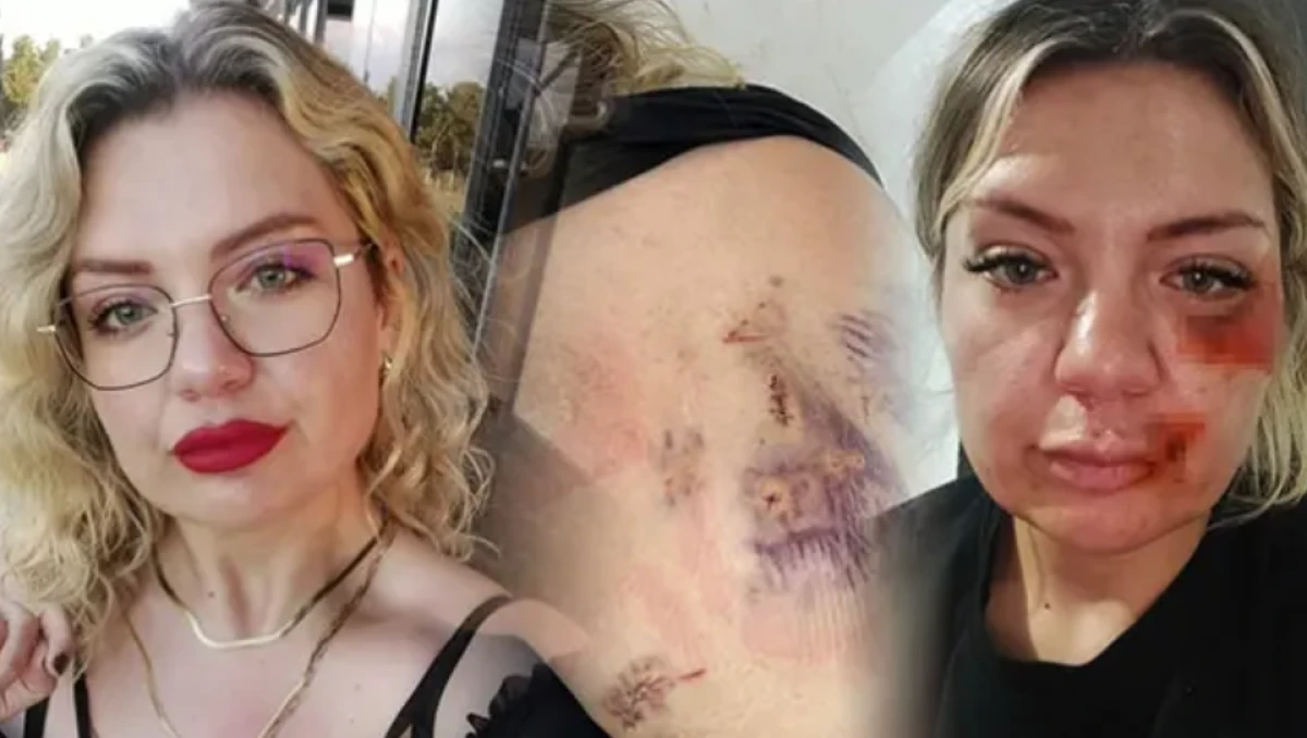 15 dakika boyunca bı&ccedil;aklanan &Ouml;zge: Bı&ccedil;ak kırılmasaydı zaten yaşama şansım yoktu