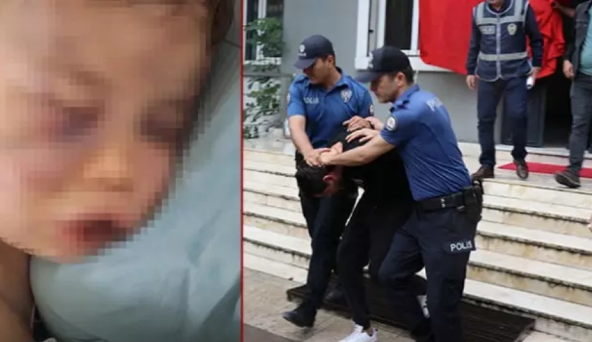 2 yaşındaki bebeği darbederek hastanelik etmişlerdi! 