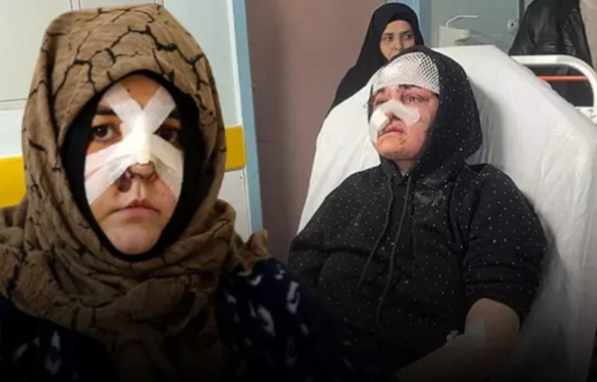 27 yaşındaki Nazlı dehşeti yaşadı! Kaldırım taşı 'silah' sayıldı 