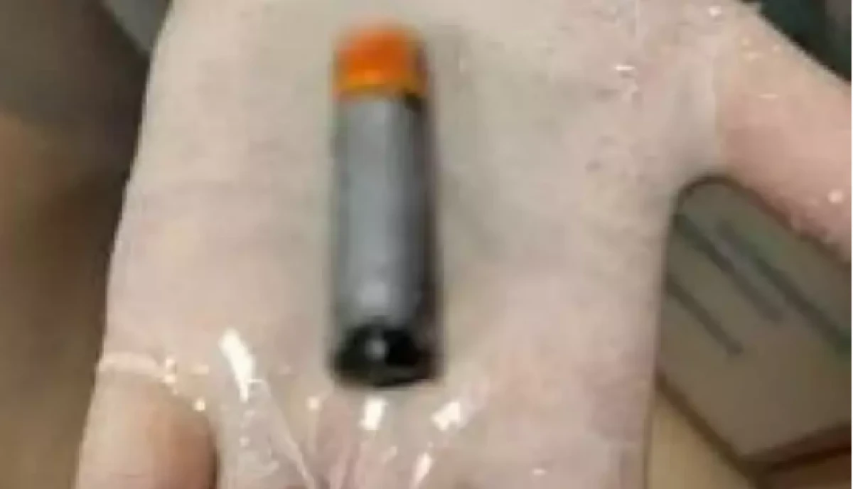 39 yaşındaki bir hastanın midesinden pil çıktı 
