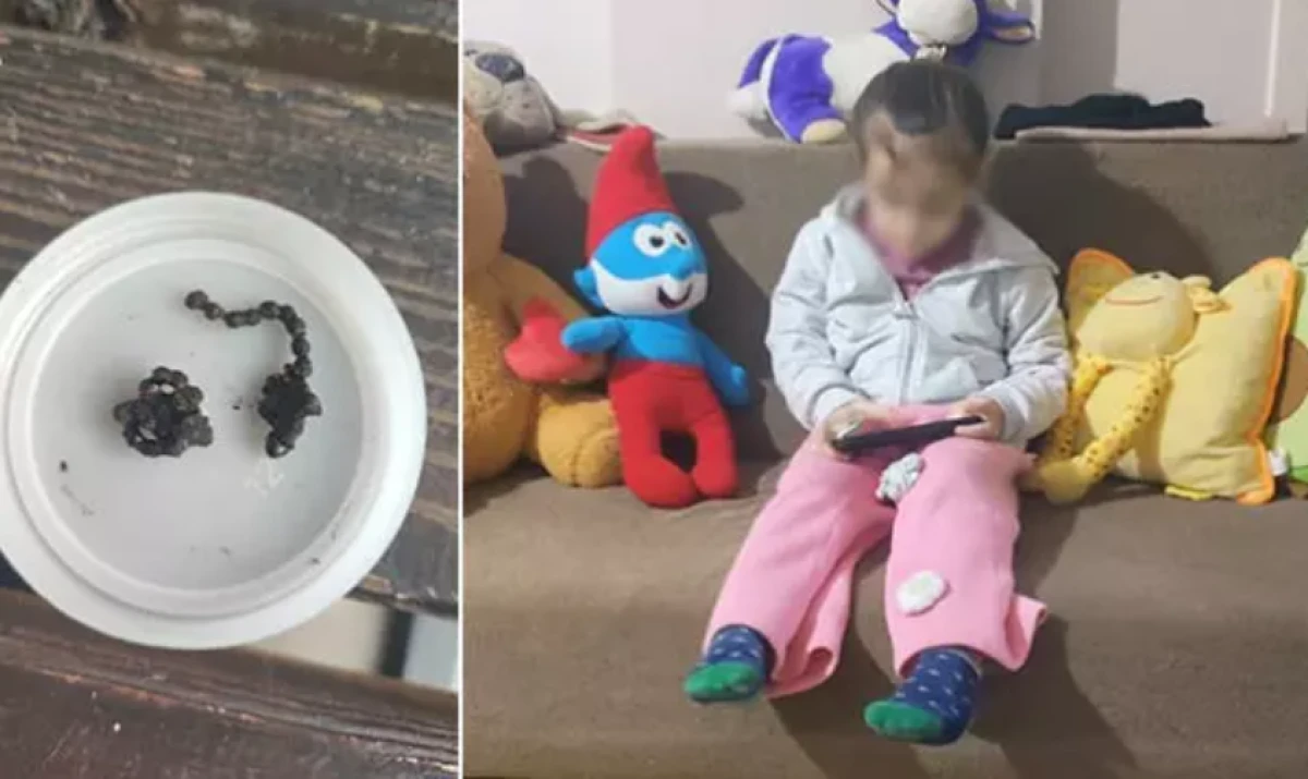 5 yaşındaki &ccedil;ocuğun burnundan &ccedil;ıkan şoke etti          