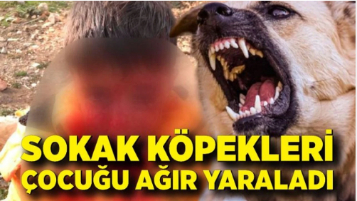 Adıyaman'da başıboş köpeklerin saldırdığı çocuk ağır yaralandı