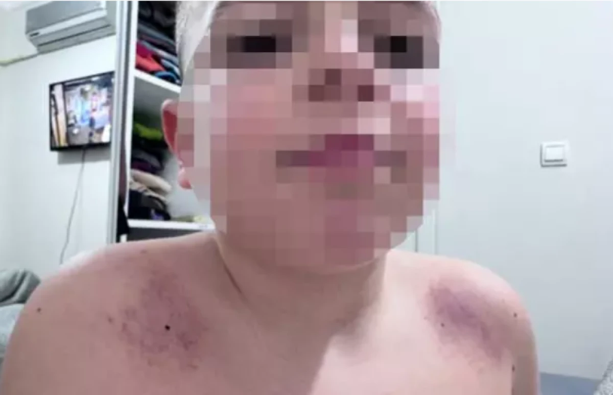 Antalya'da İlkokulda darp iddiası                      