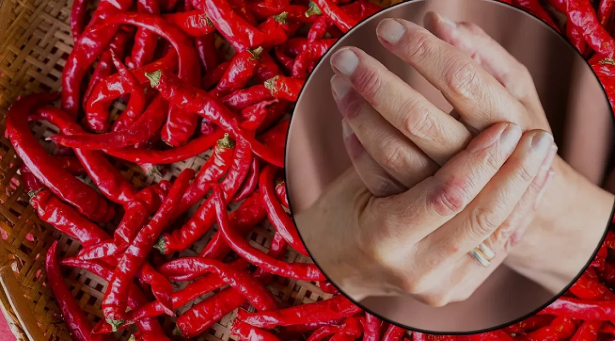 Eldeki biber yanmasına ne iyi gelir?                