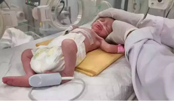 Gazze'de annesinin karnından alınan bebek vefat etti