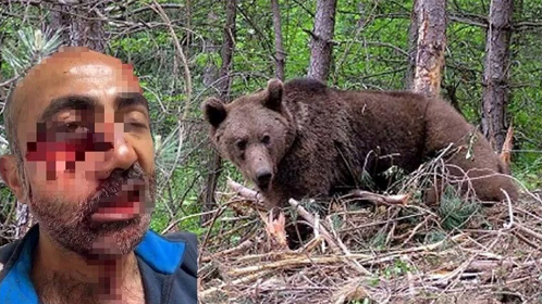 Hakkari'de ayı saldırısı: Yüzü ve çenesi parçalandı 