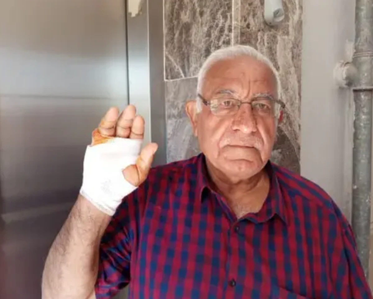 Hatay'da akılalmaz hadise: Komşusunun ısırdığı parmak koparıldı