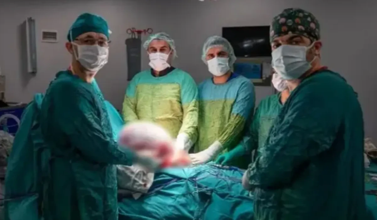 Karın ağrısıyla doktora gitti ger&ccedil;eği g&ouml;r&uuml;nce şaşkına d&ouml;nd&uuml;! Tam 15 kg &ccedil;ıkarıldı...