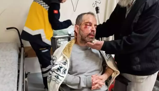 Konya’da köpek saldırısı!                  