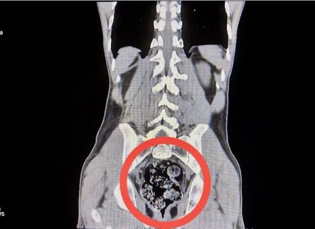 Kuryenin uyuşturucuyu sakladığı yer herkesi şaşırttı 