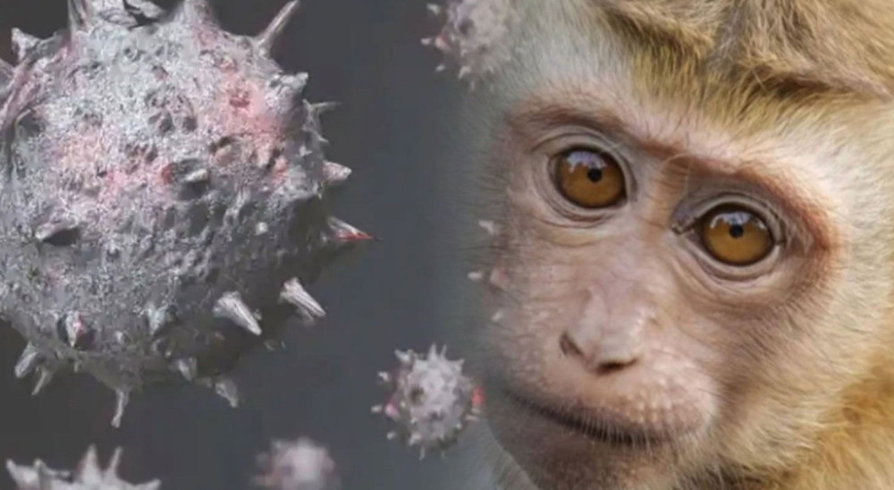 Maymun çiçeği virüsü spermde görüldü