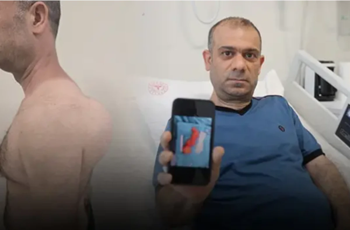 Sırtındaki şişliği &ouml;nemsemedi! Yıllar i&ccedil;inde b&uuml;y&uuml;d&uuml;! Doktorları şoke eden vaka