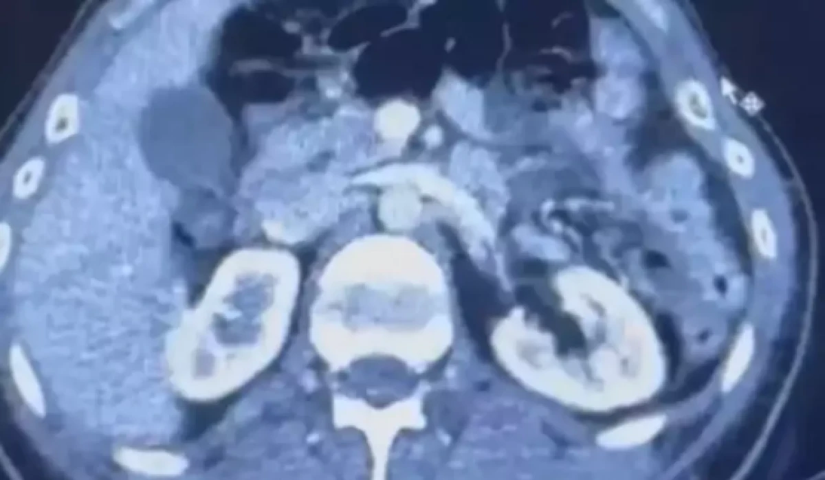 Üç İranlı röntgene girince yakayı ele verdi 