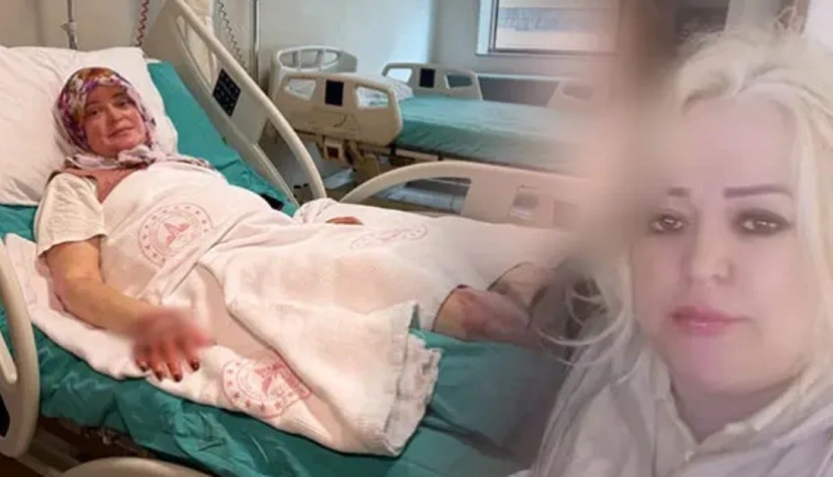 V&uuml;cudunun y&uuml;zde 70'i yanan kadın uyardı: Satın alırken dikkat etsinler