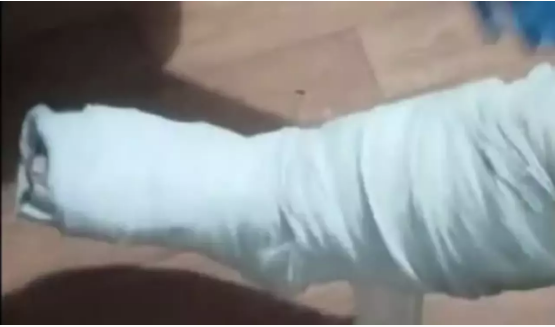 Yolcunun ayağına sarılı alçından eroin çıktı 