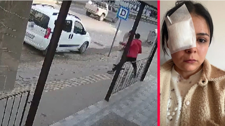 Yolda yürüyen kadına yumruklu saldırı    